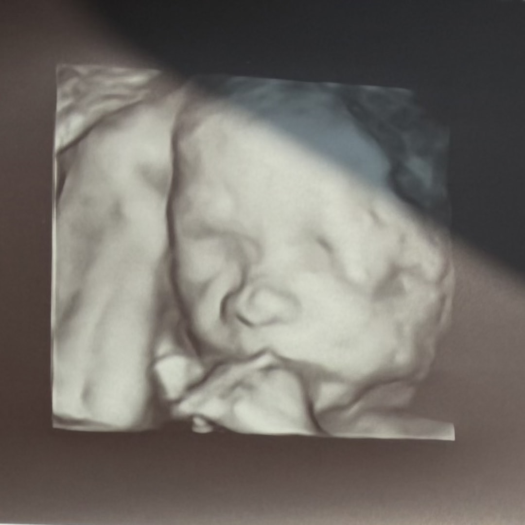 Photo shared by Alexandra for their Babylist baby registry.