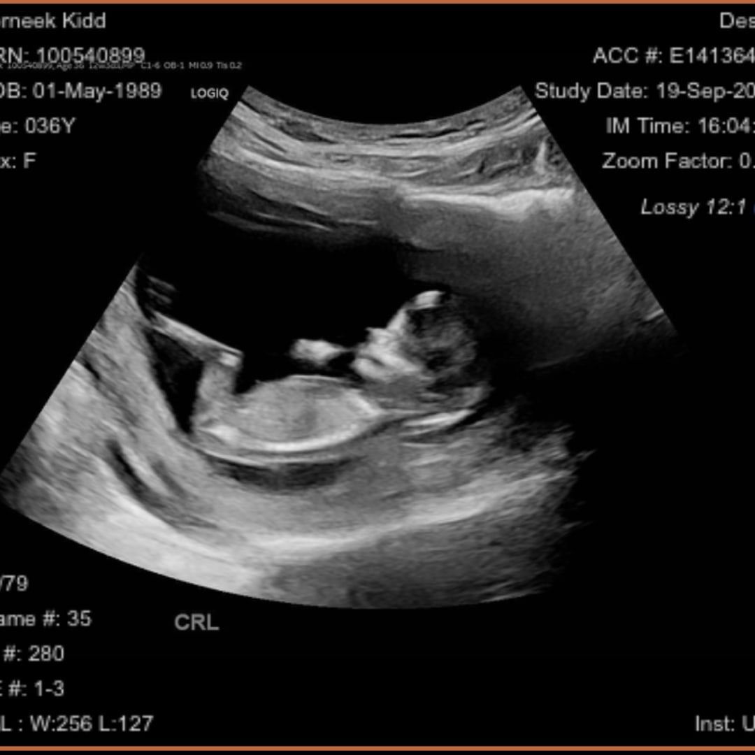 Photo shared by Dorneek for their Babylist baby registry.