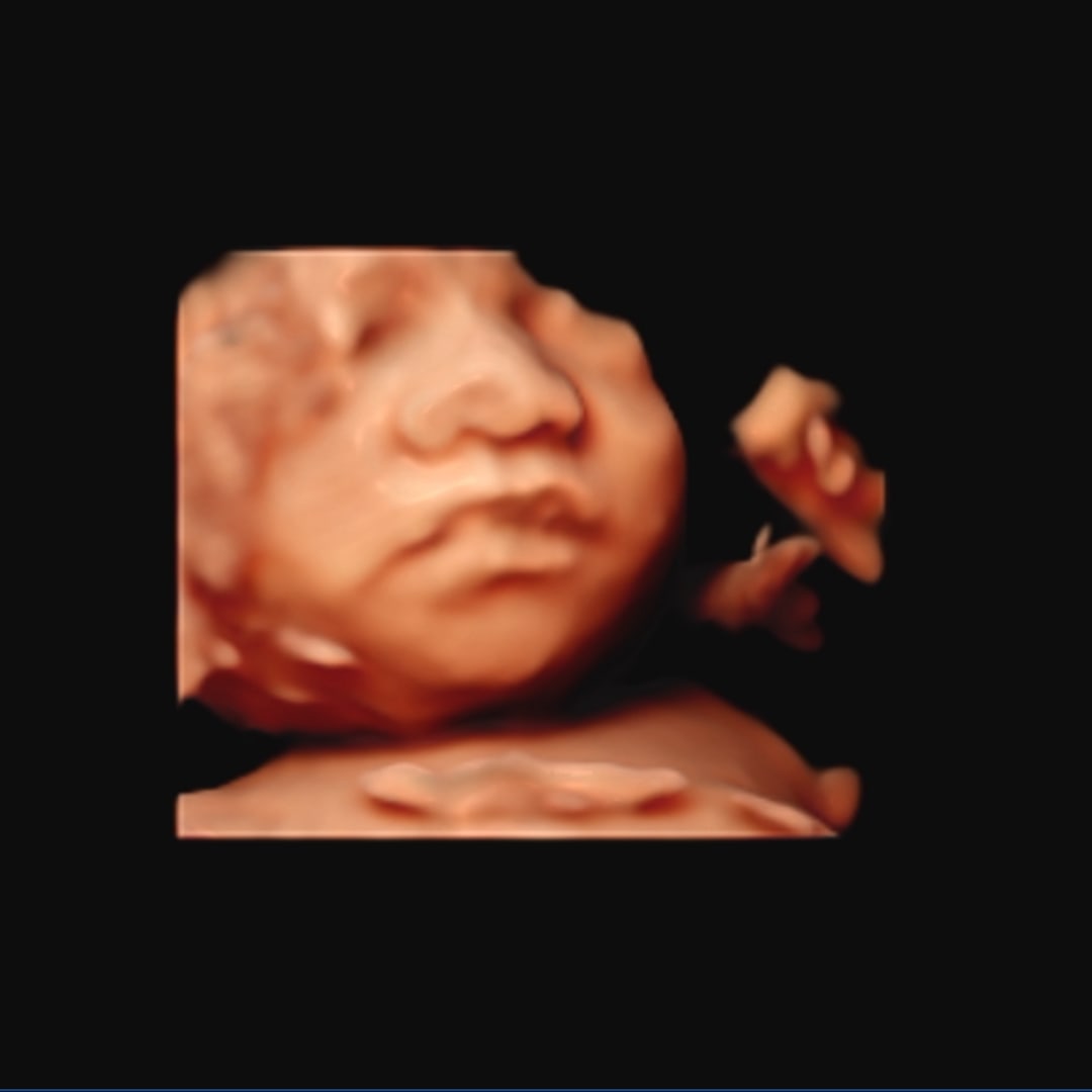 Photo shared by Mom for their Babylist baby registry.