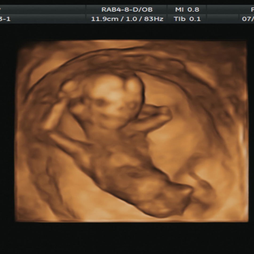 Photo shared by Anna for their Babylist baby registry.