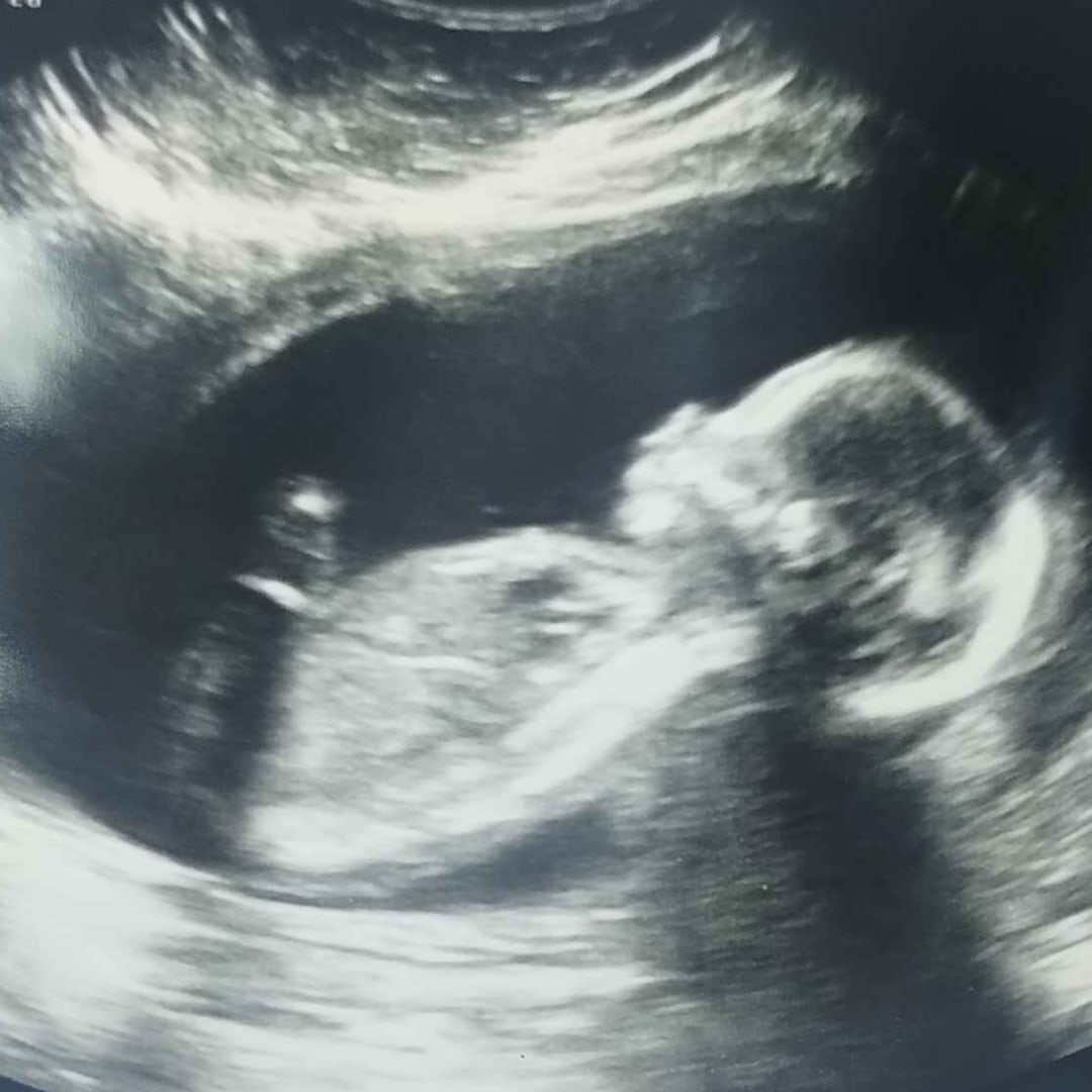Photo shared by Tone for their Babylist baby registry.
