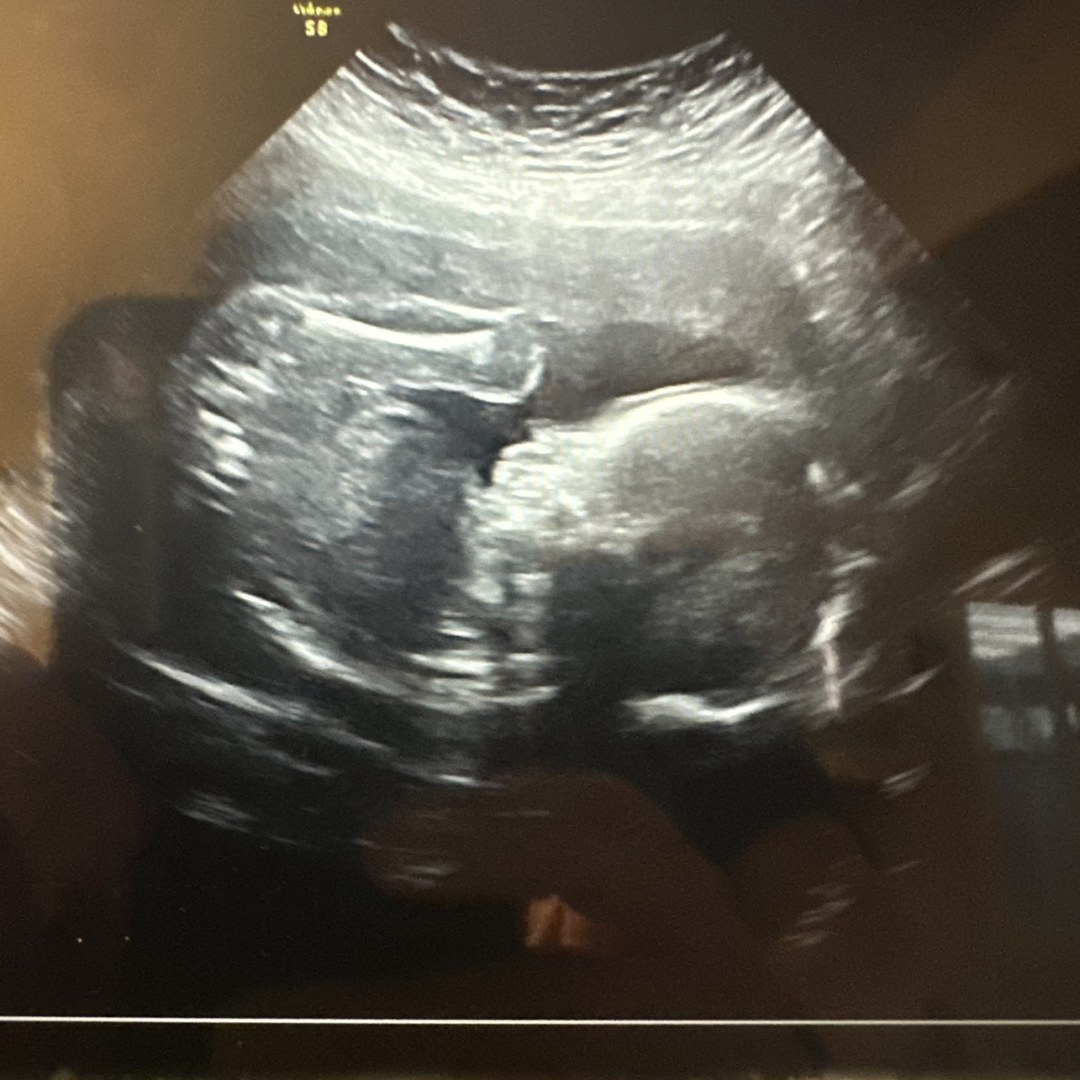 Photo shared by Carol for their Babylist baby registry.