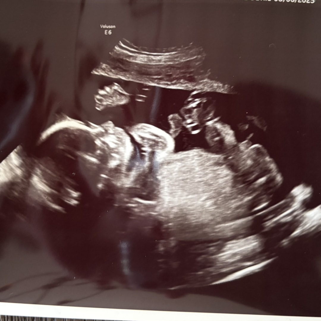 Photo shared by Lauren for their Babylist baby registry.