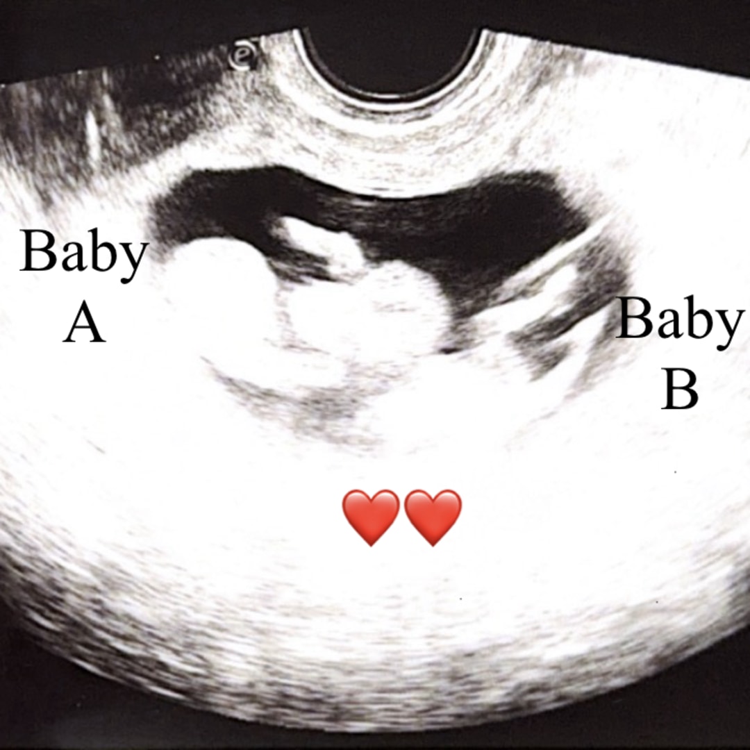 Photo shared by Bridget for their Babylist baby registry.