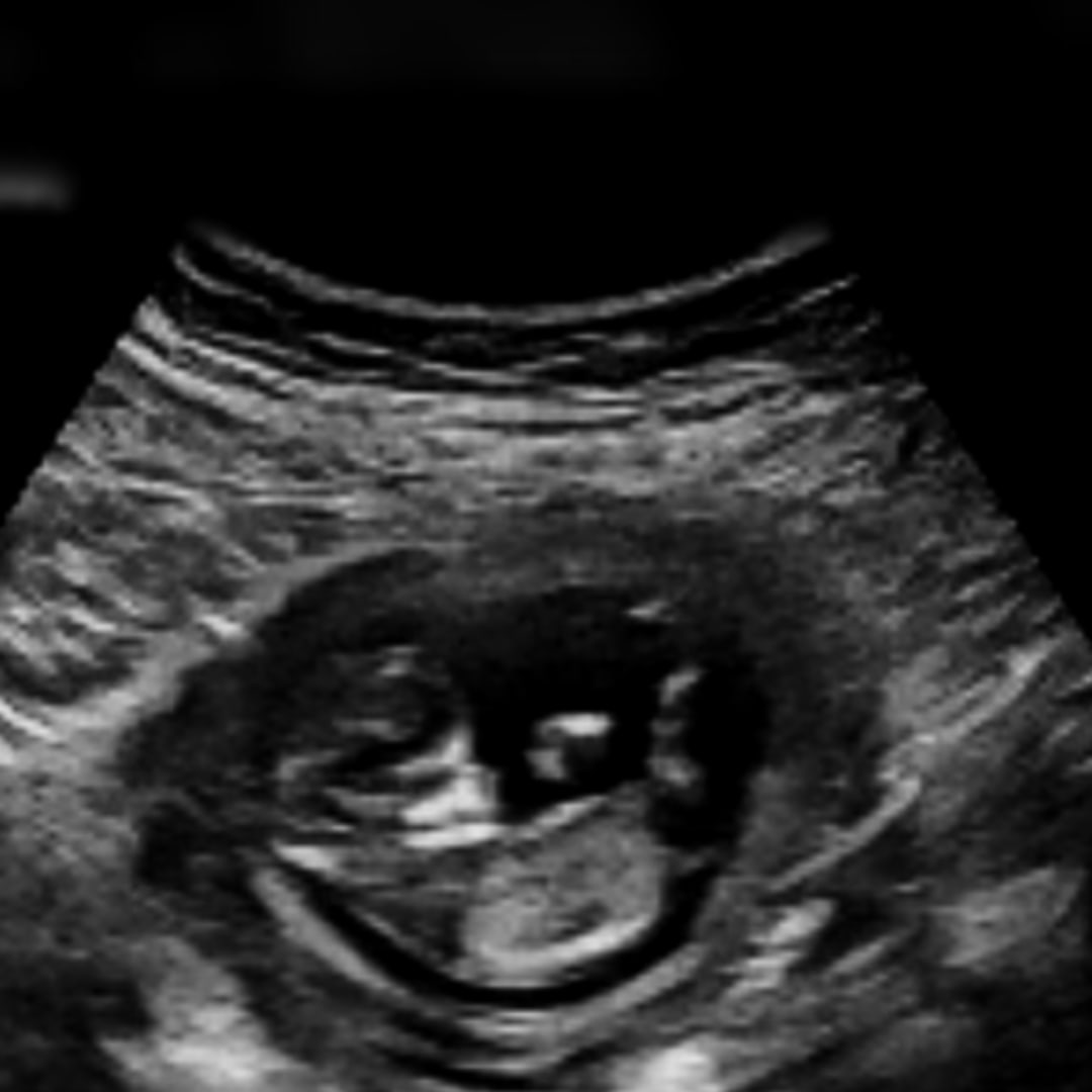 Photo shared by Grace for their Babylist baby registry.