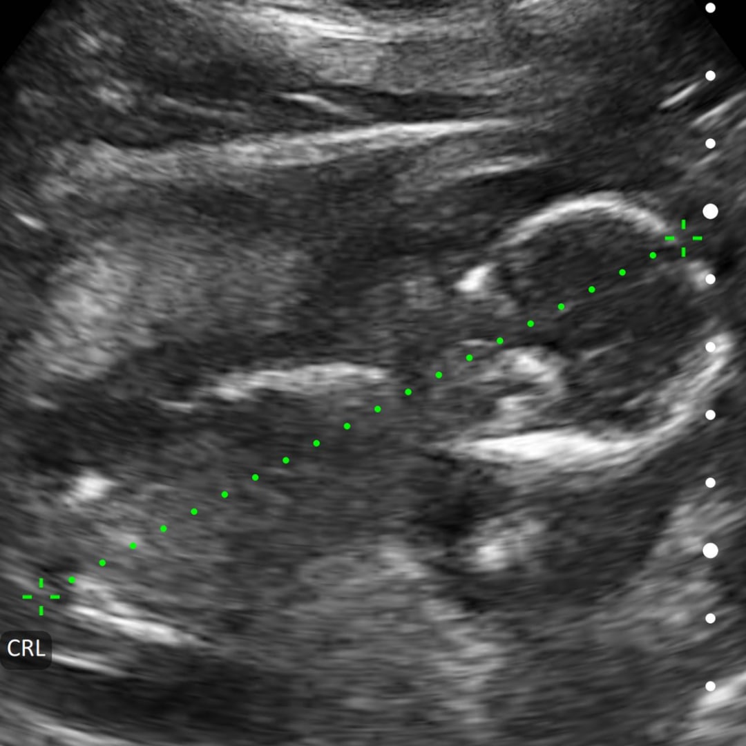 Photo shared by Sylvii for their Babylist baby registry.