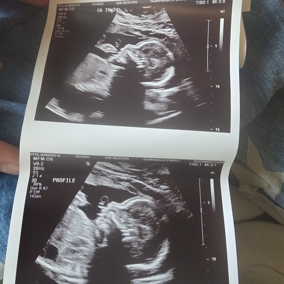Photo shared by Marjorie for their Babylist baby registry.