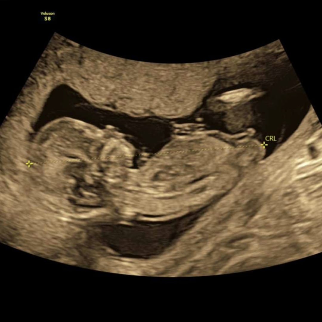 Photo shared by Sally for their Babylist baby registry.