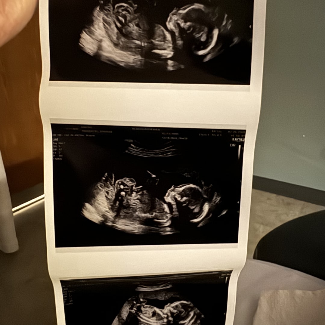 Photo shared by Jennifer for their Babylist baby registry.