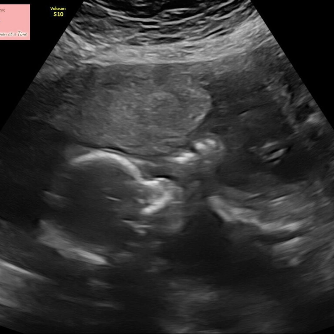 Photo shared by Amy for their Babylist baby registry.