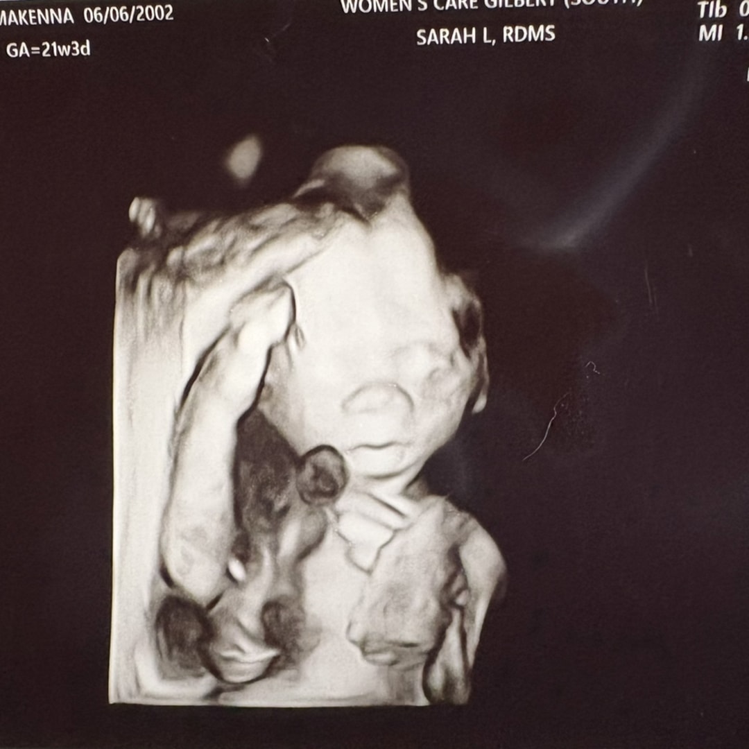 Photo shared by MaKenna for their Babylist baby registry.