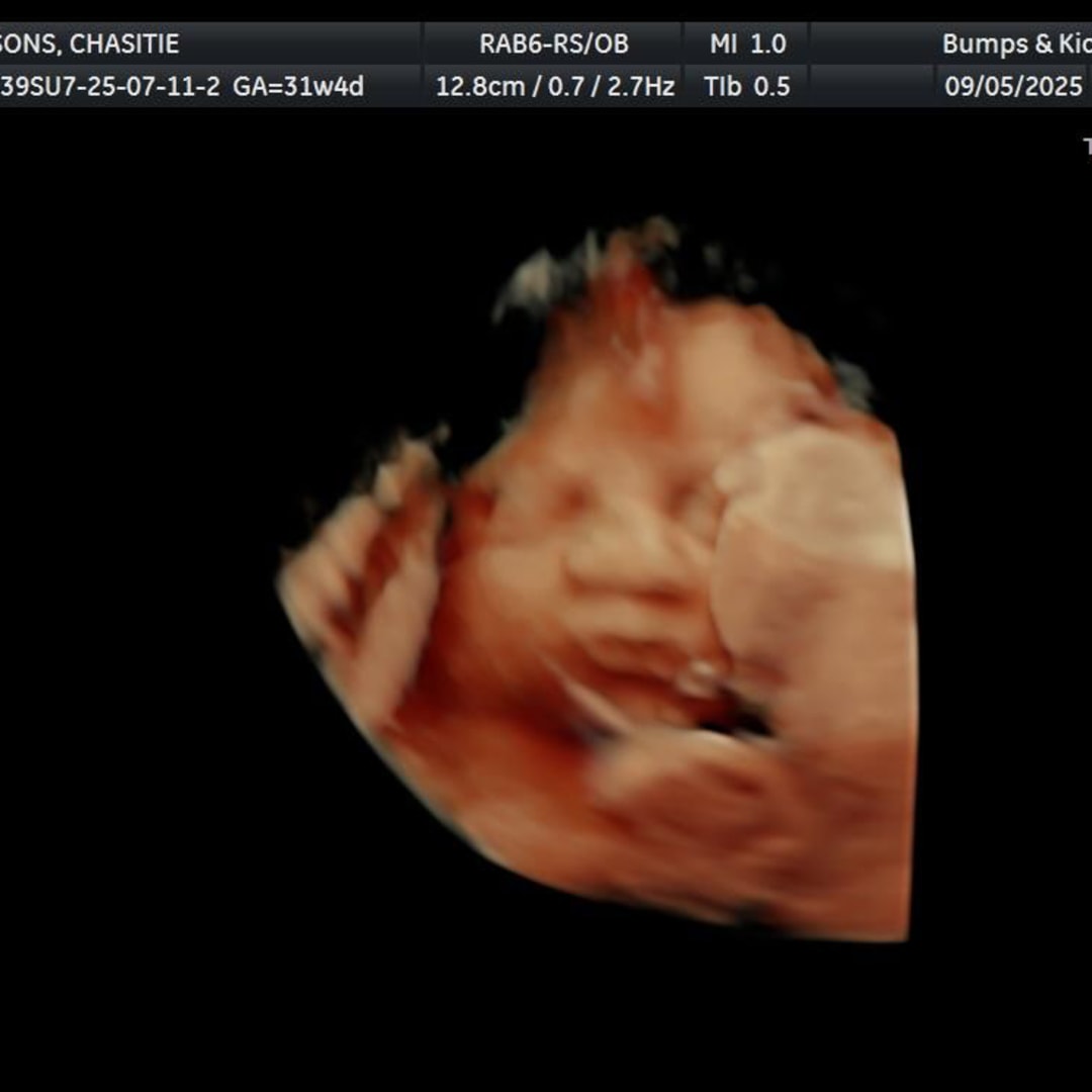 Photo shared by Chasitie for their Babylist baby registry.