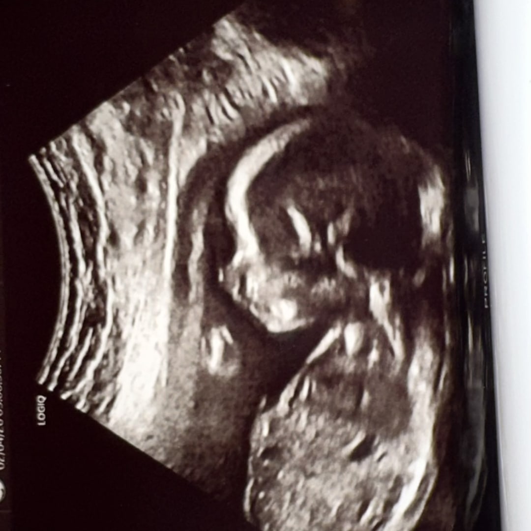 Photo shared by Charlie for their Babylist baby registry.