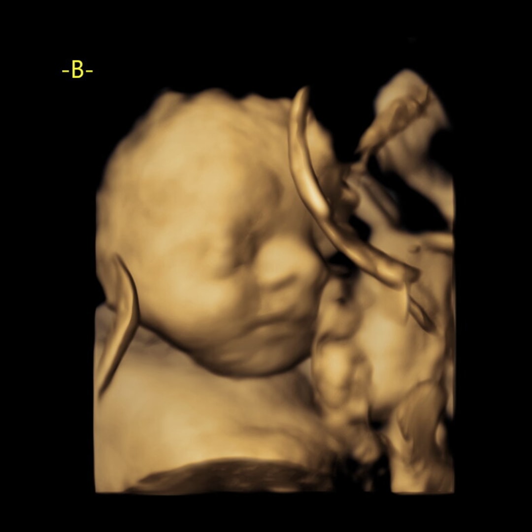 Photo shared by Autumn for their Babylist baby registry.