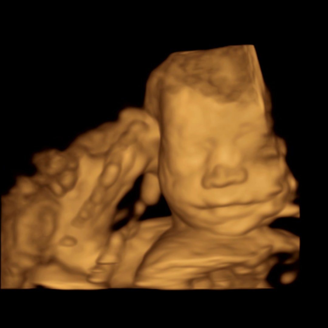 Photo shared by Isabel & Chris for their Babylist baby registry.