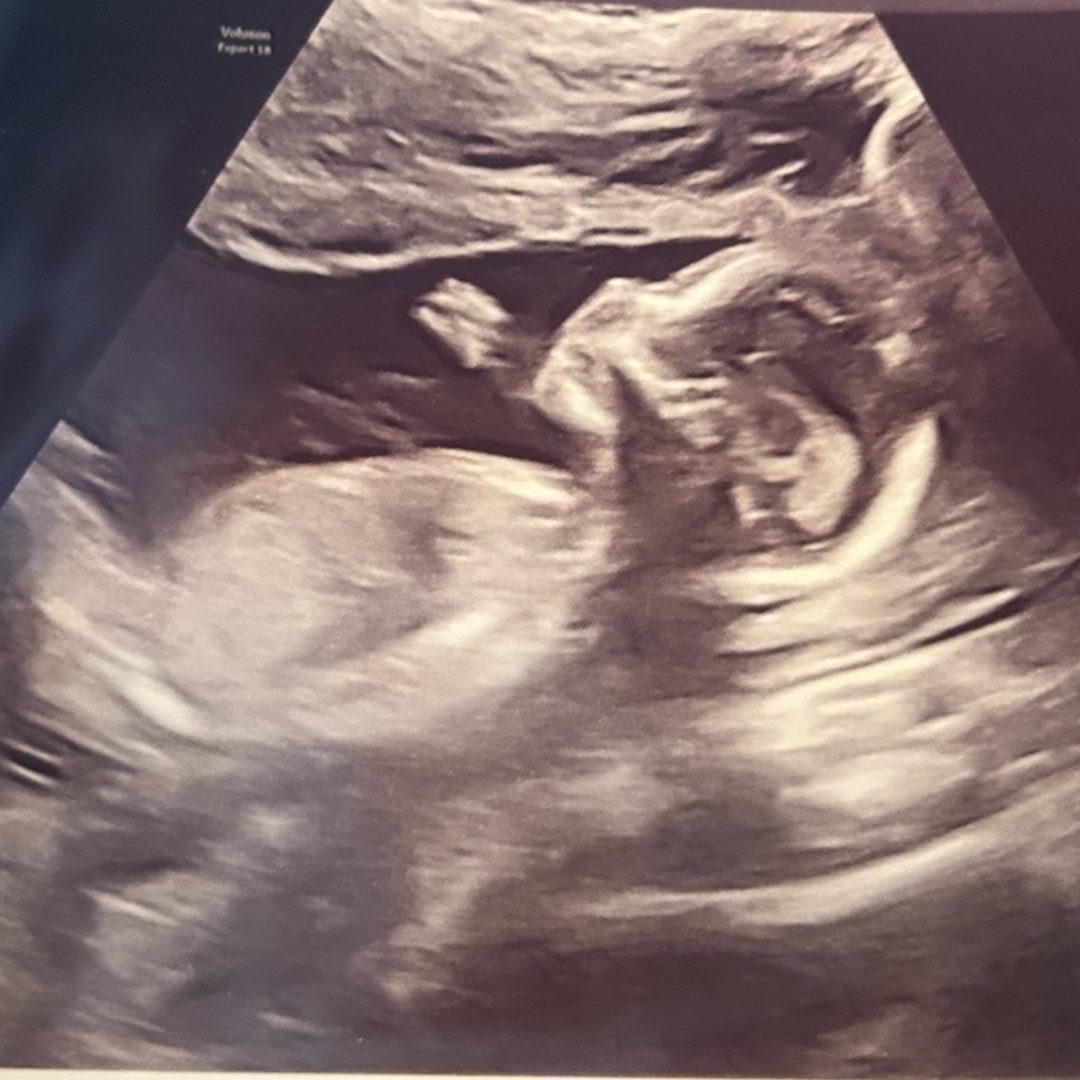 Photo shared by Ana for their Babylist baby registry.