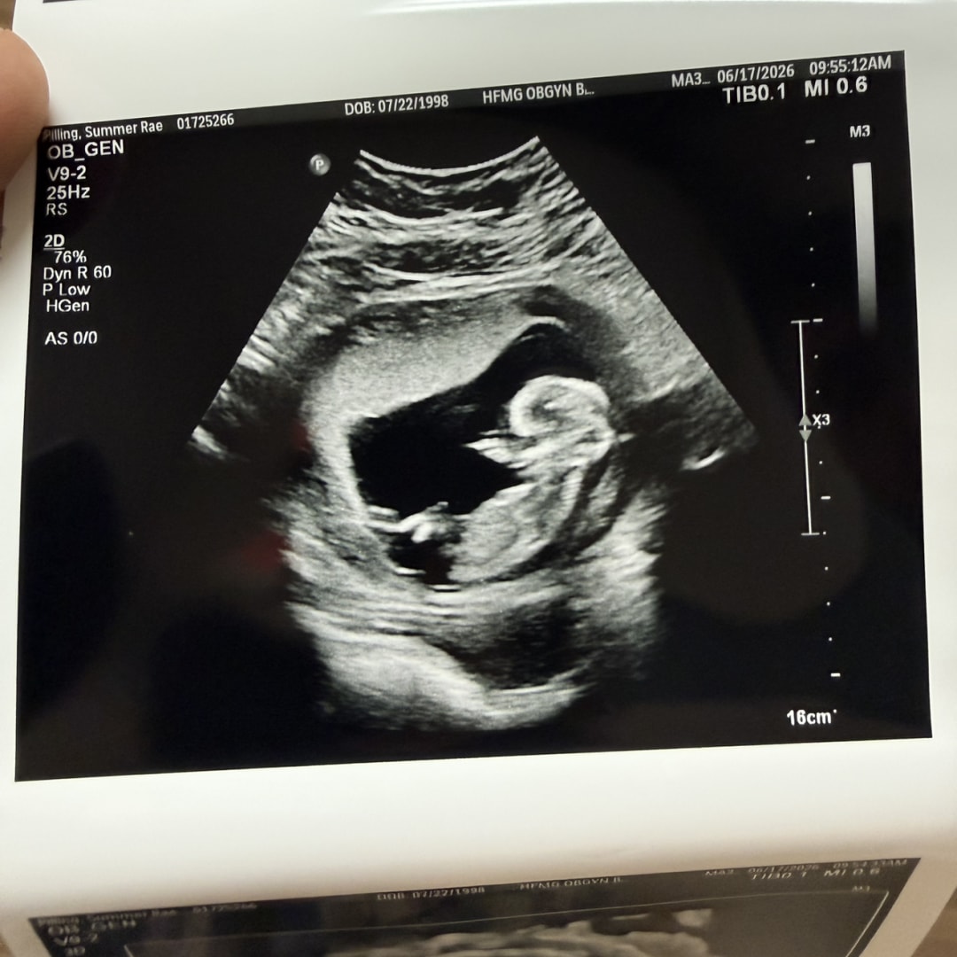 Photo shared by Summer for their Babylist baby registry.