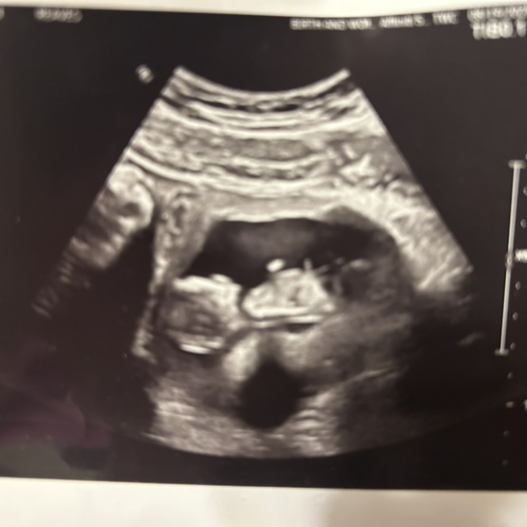 Photo shared by Kathryn for their Babylist baby registry.