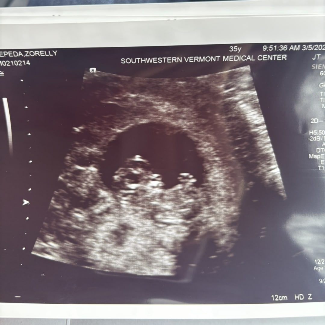 Photo shared by Zorelly for their Babylist baby registry.