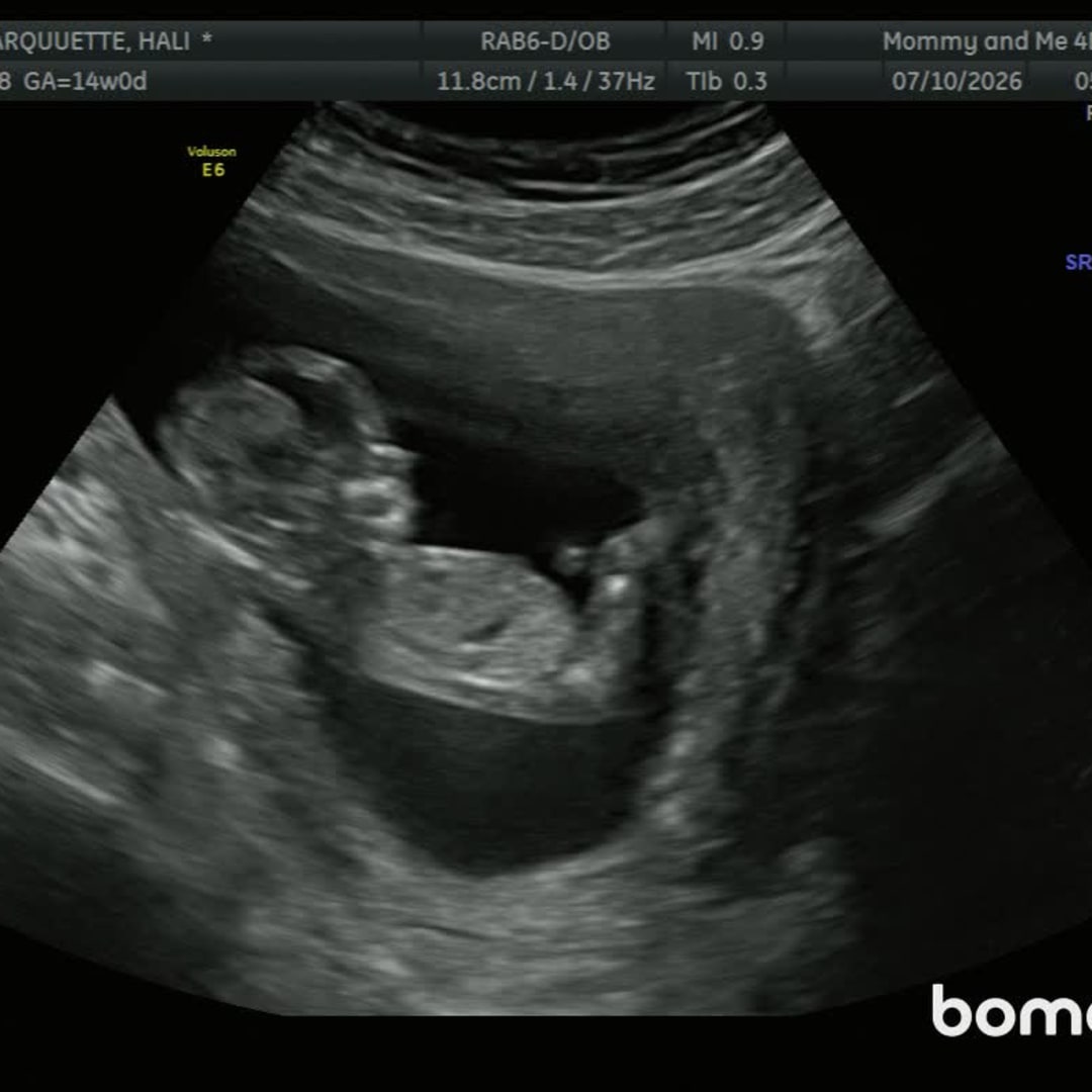 Photo shared by Hali for their Babylist baby registry.
