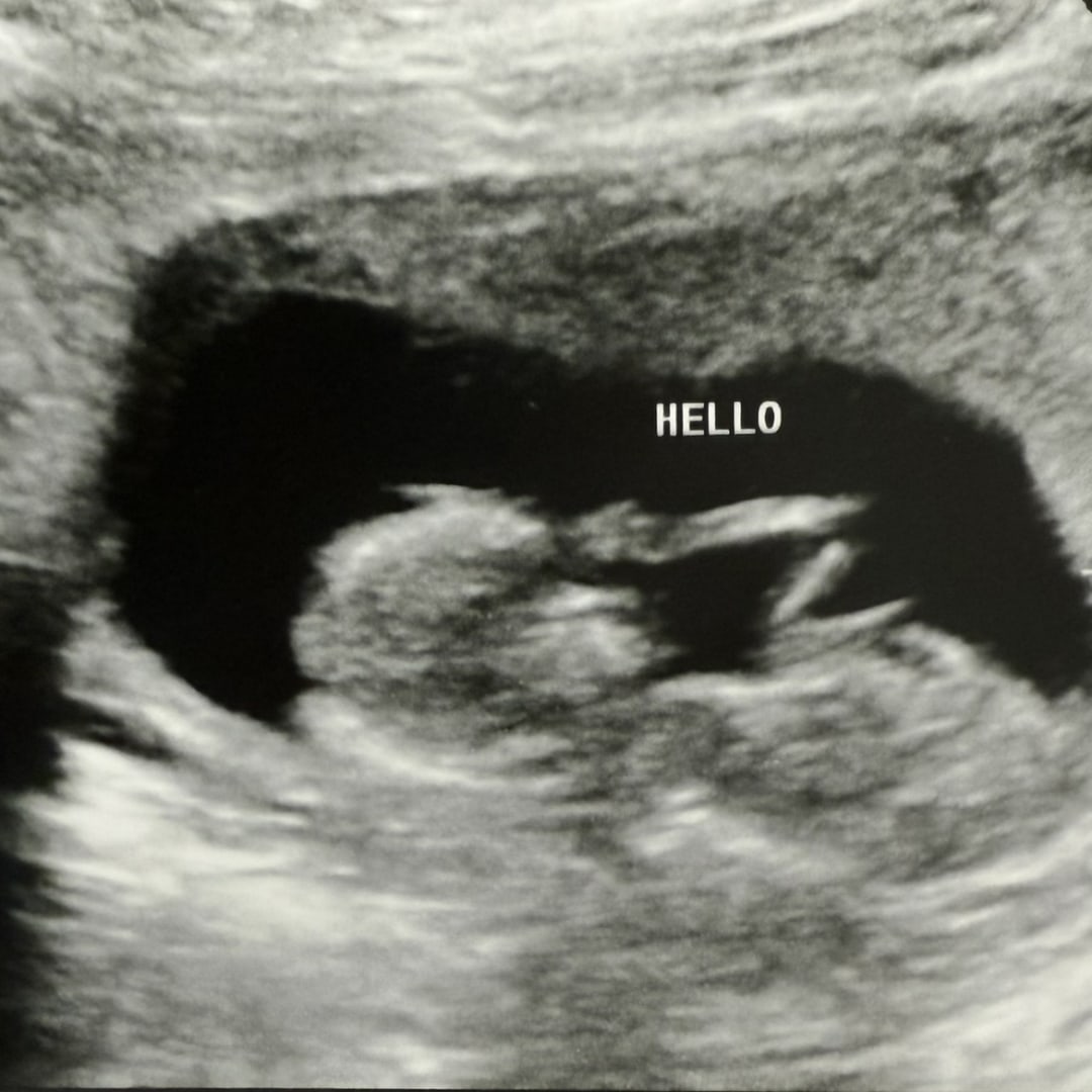 Photo shared by Chelsea for their Babylist baby registry.