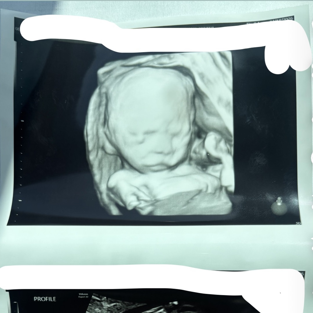 Photo shared by Ashley for their Babylist baby registry.