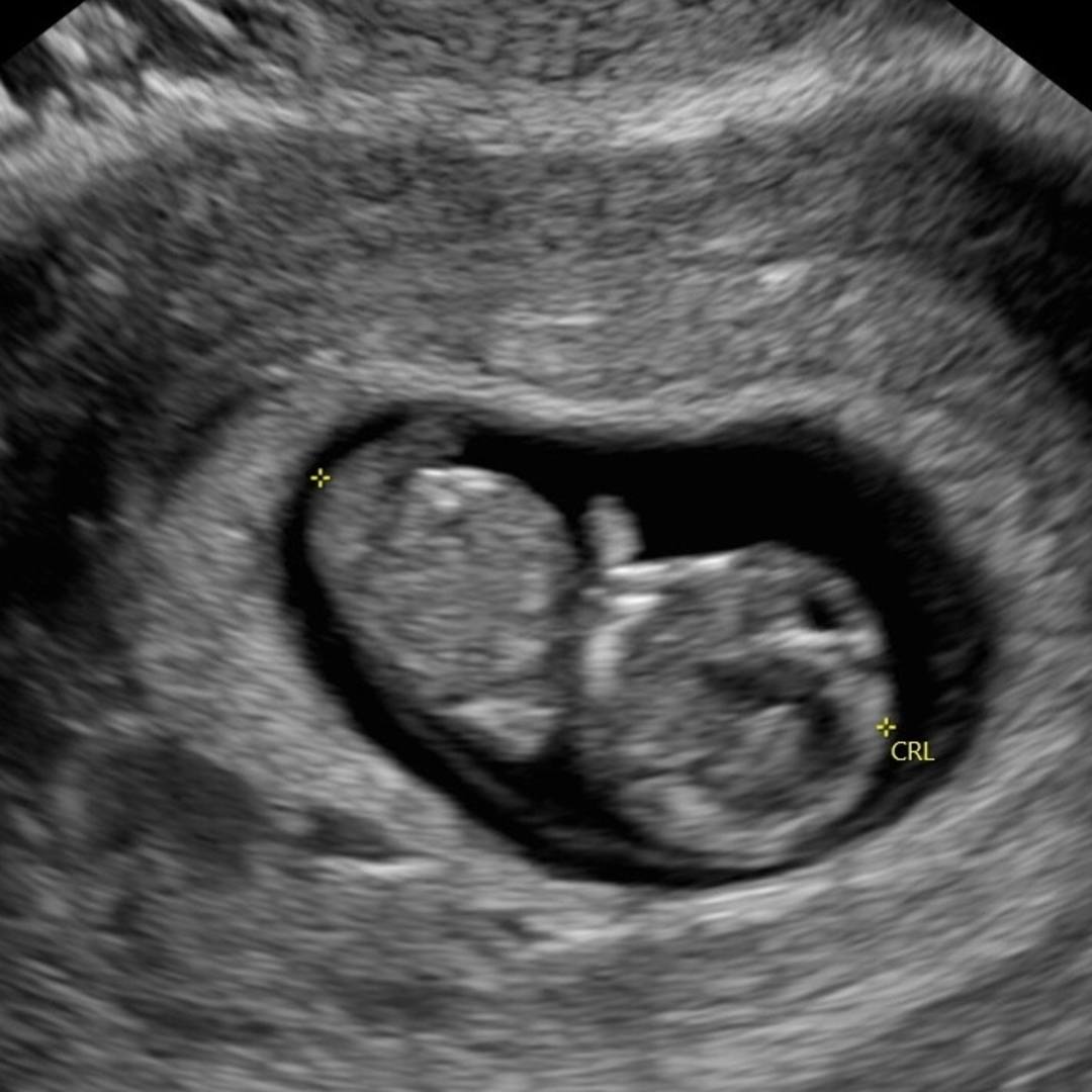 Photo shared by Brittiany for their Babylist baby registry.