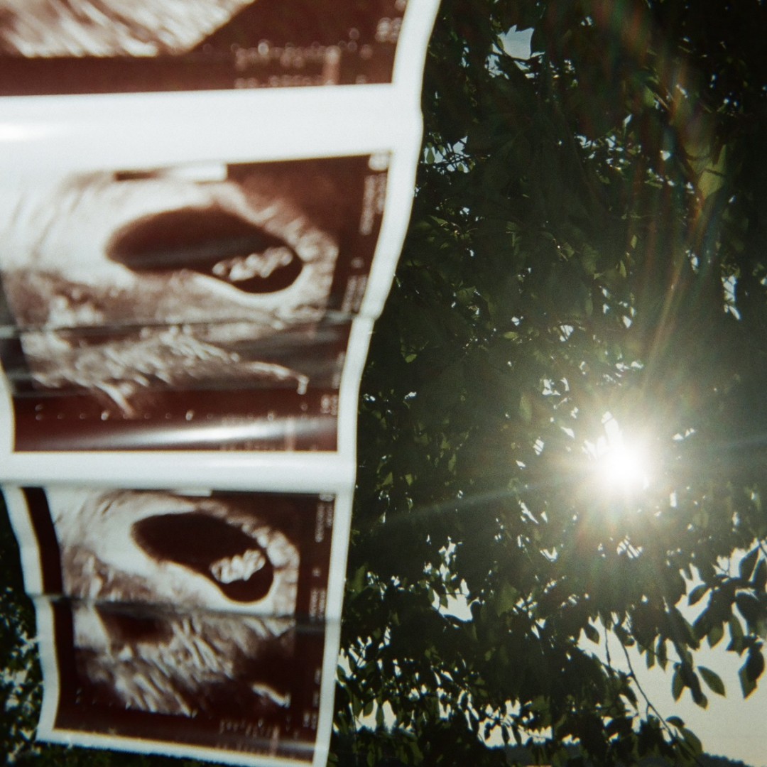 Photo shared by Shelby for their Babylist baby registry.