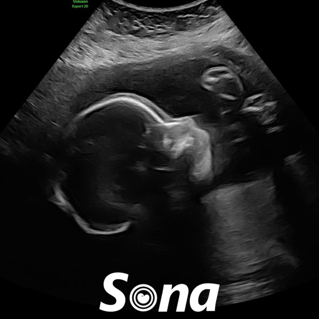 Photo shared by Casey for their Babylist baby registry.