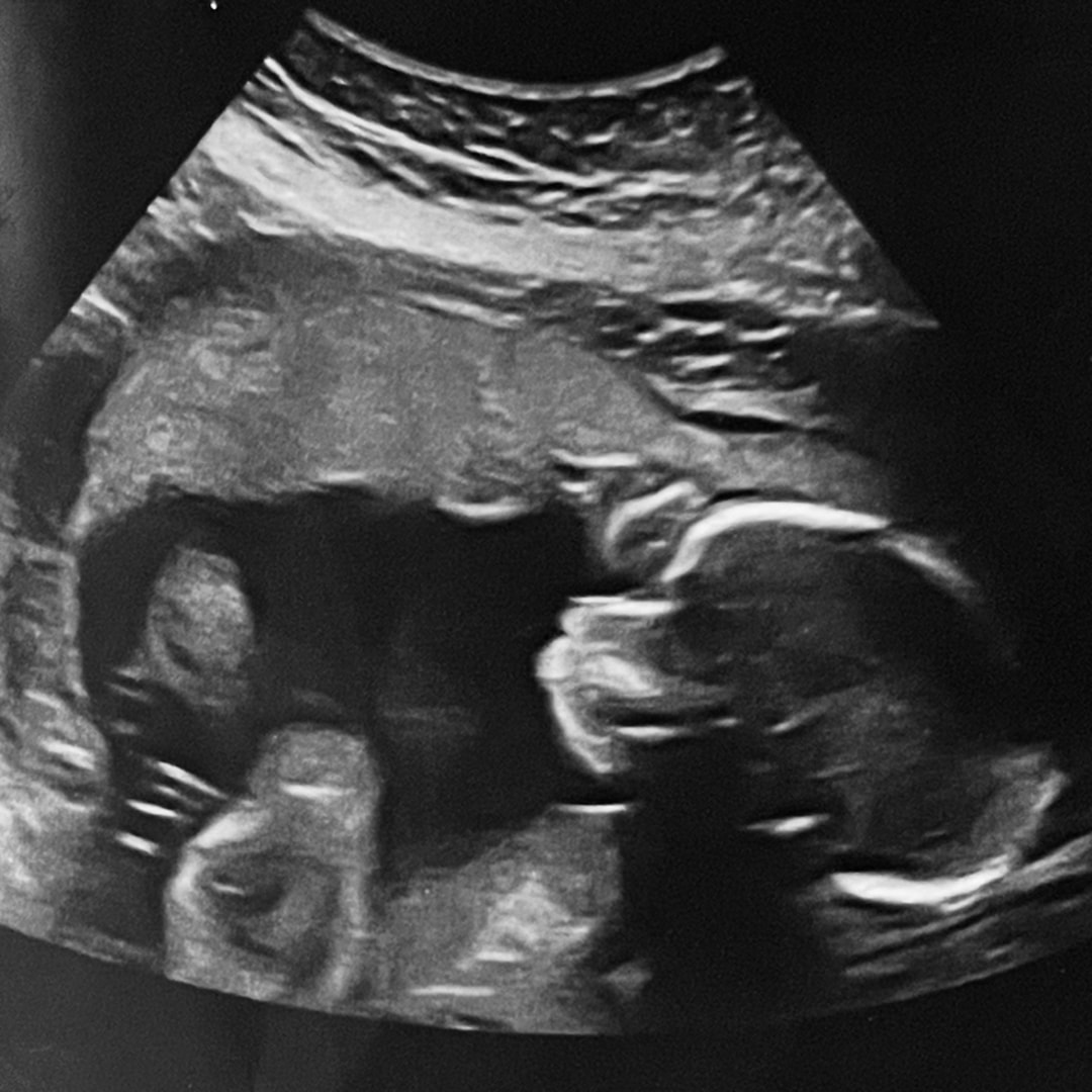 Photo shared by Becca for their Babylist baby registry.