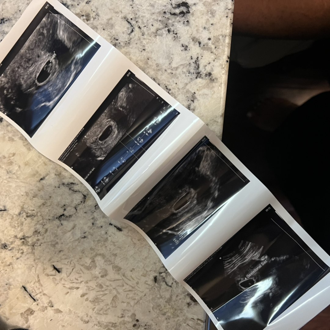 Photo shared by Sydney for their Babylist baby registry.