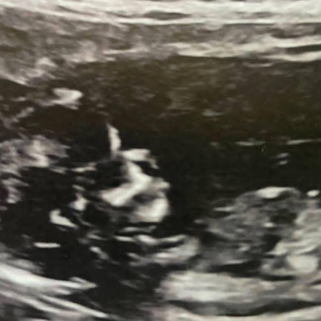 Photo shared by Asianna for their Babylist baby registry.