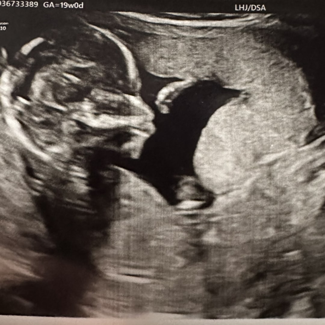 Photo shared by Chivu for their Babylist baby registry.