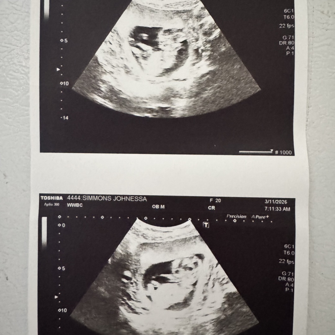 Photo shared by Johnessa for their Babylist baby registry.