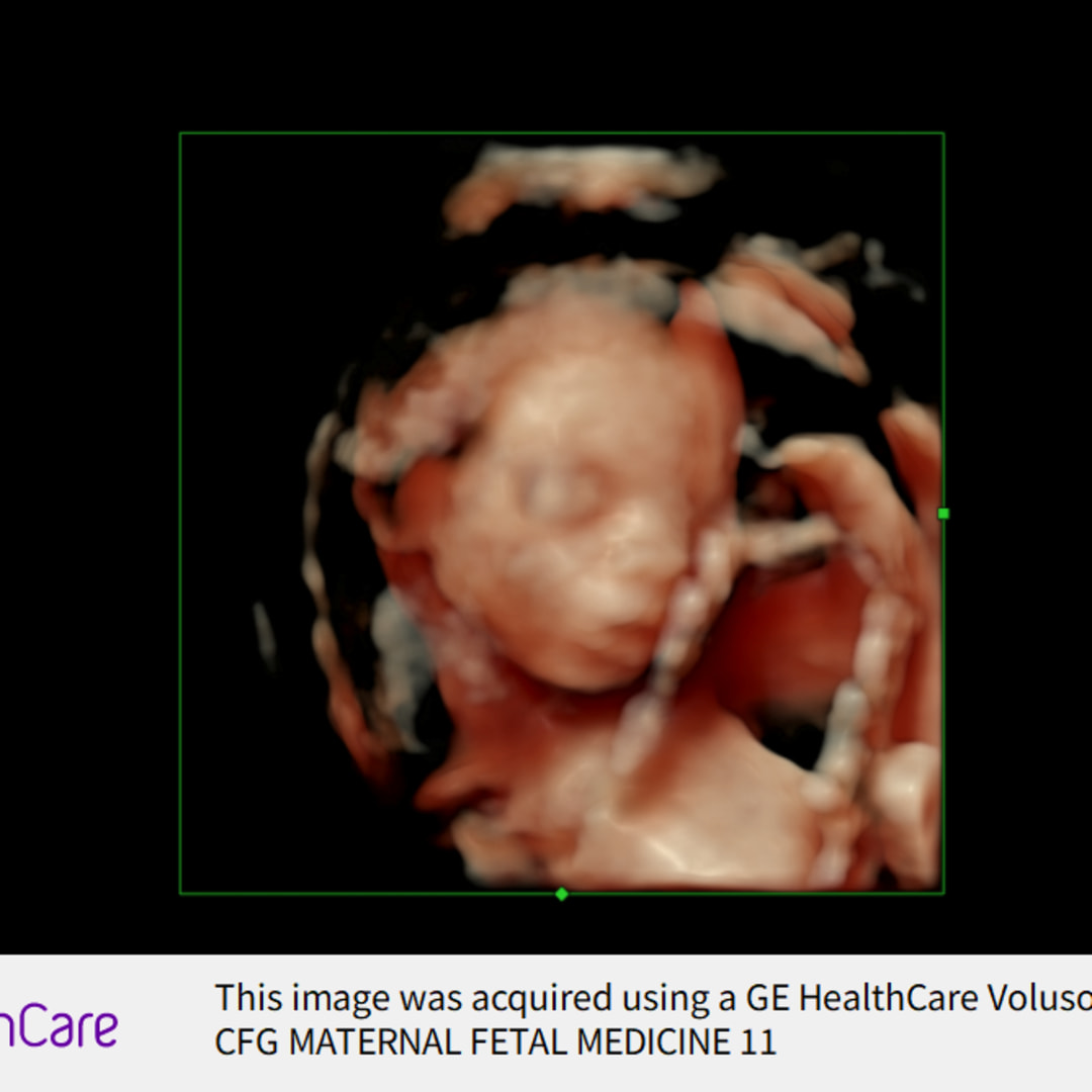 Photo shared by Tiffany for their Babylist baby registry.