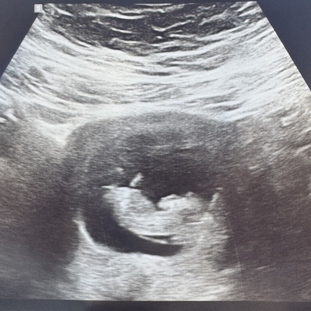 Photo shared by Samantha for their Babylist baby registry.