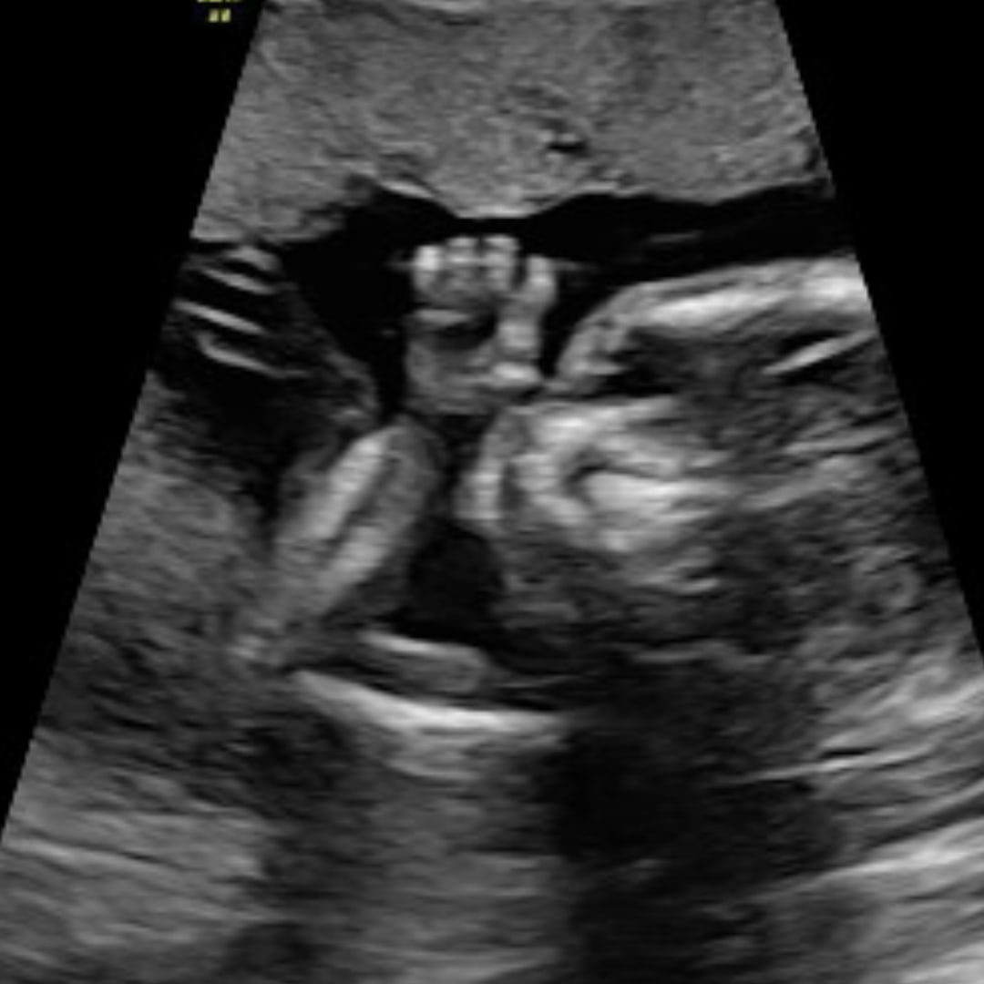 Photo shared by Alexis for their Babylist baby registry.