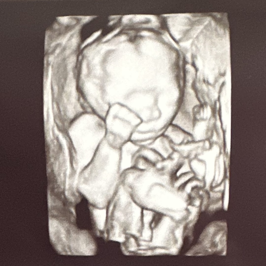 Photo shared by Annie for their Babylist baby registry.