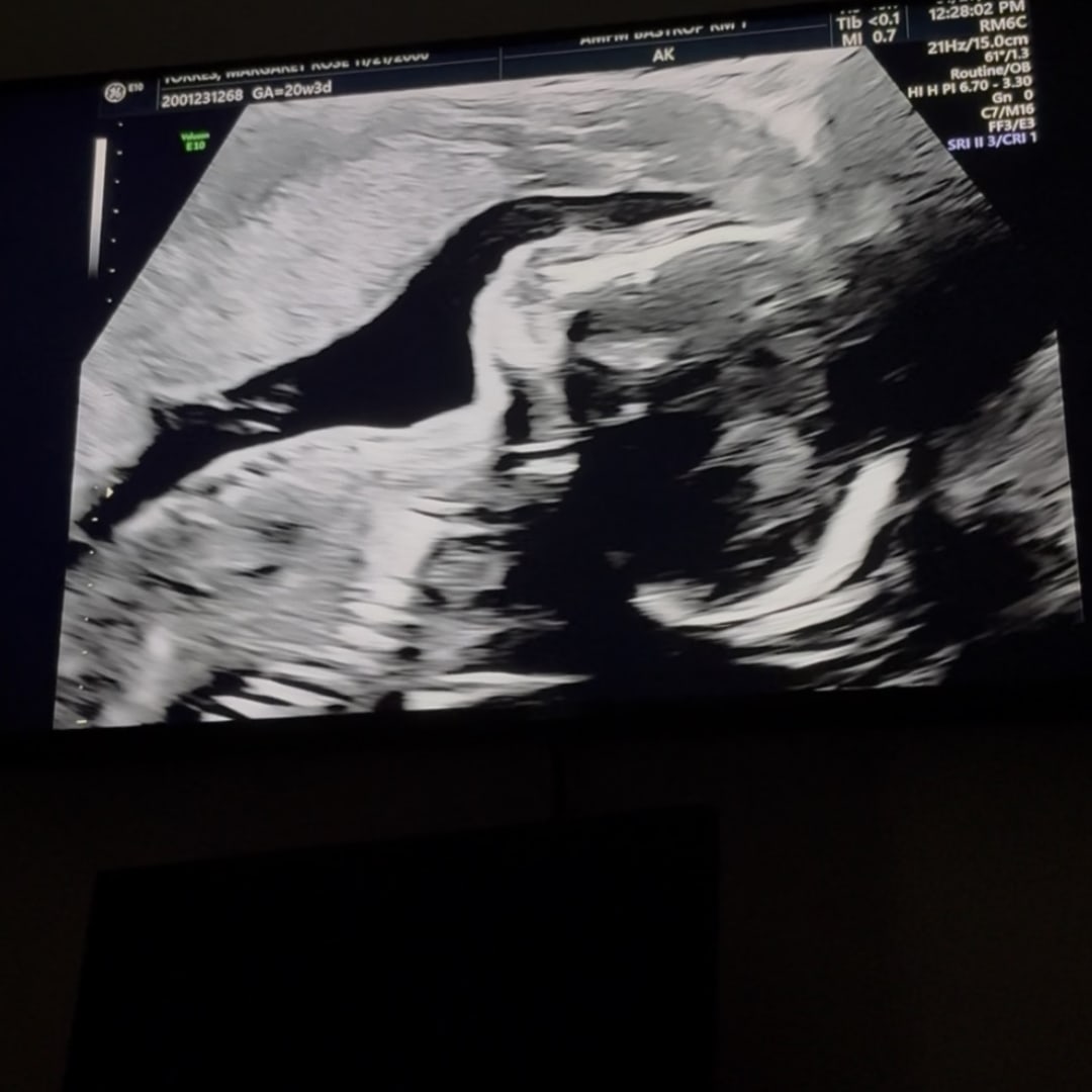 Photo shared by Margaret for their Babylist baby registry.