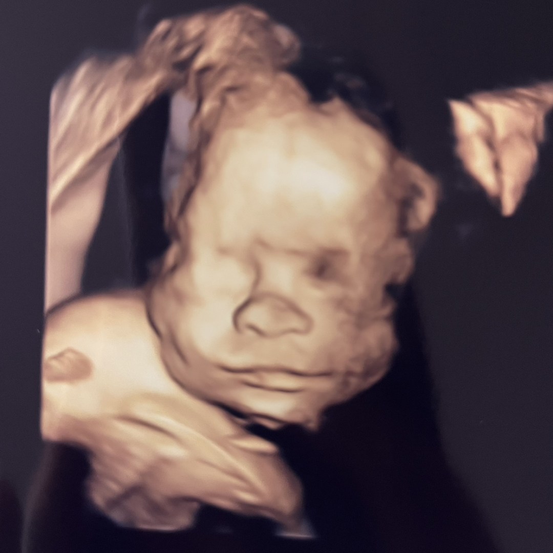 Photo shared by Elizabeth for their Babylist baby registry.