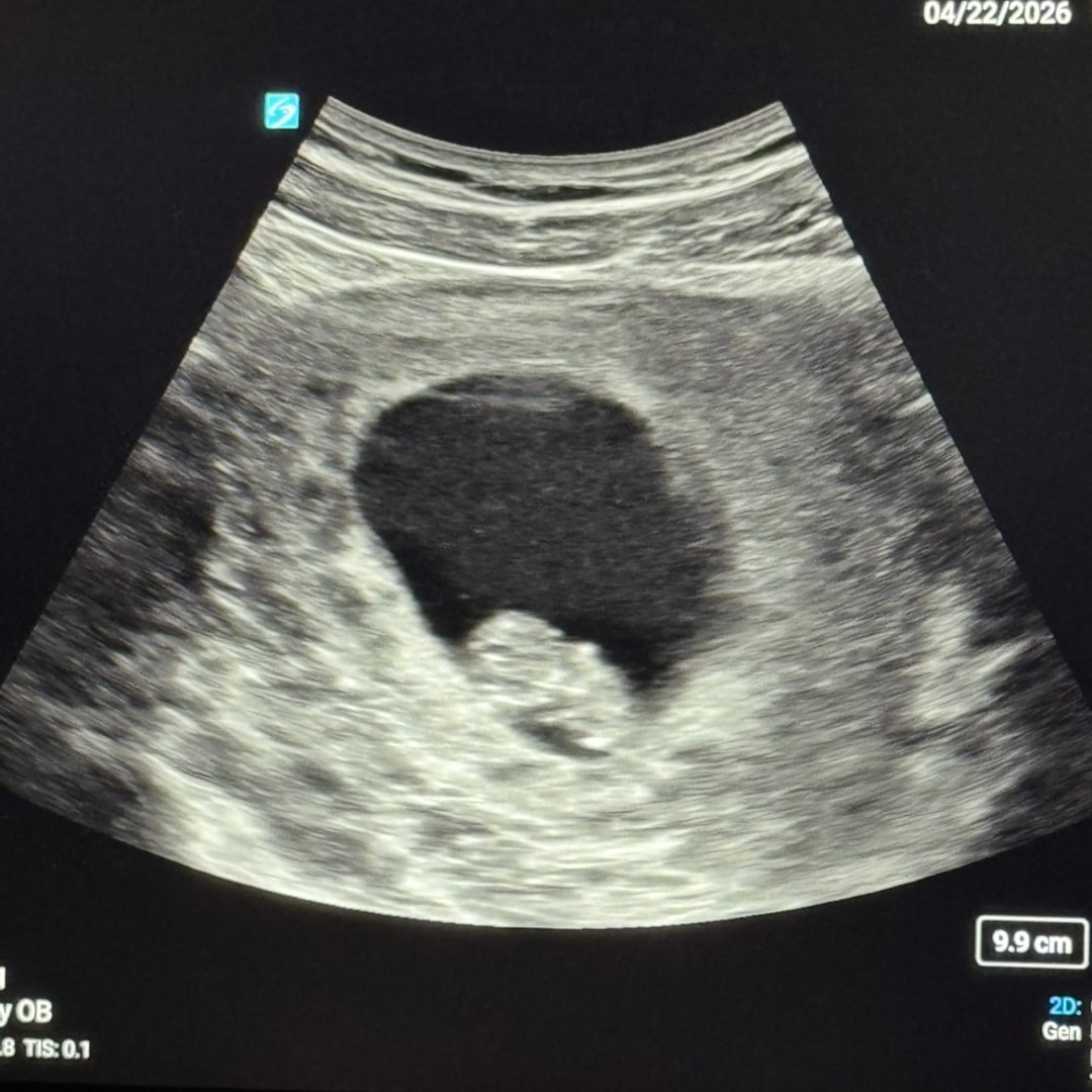 Photo shared by Laurel for their Babylist baby registry.