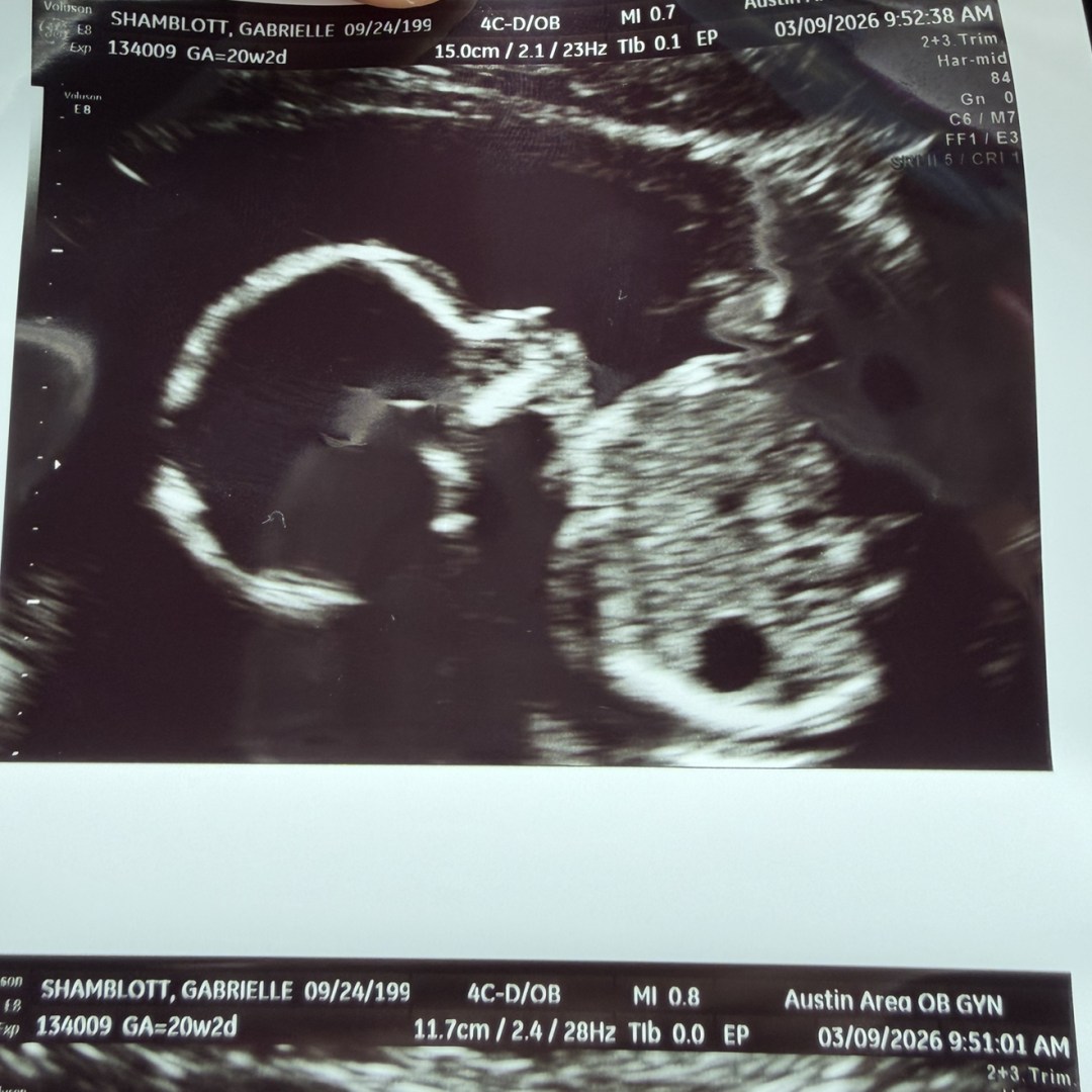 Photo shared by Gabrielle for their Babylist baby registry.