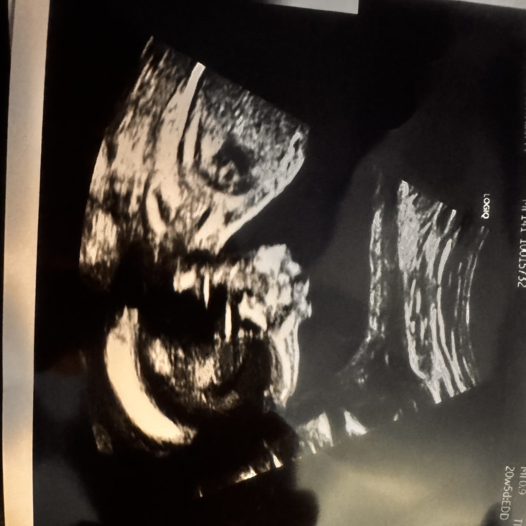 Photo shared by Chloe for their Babylist baby registry.