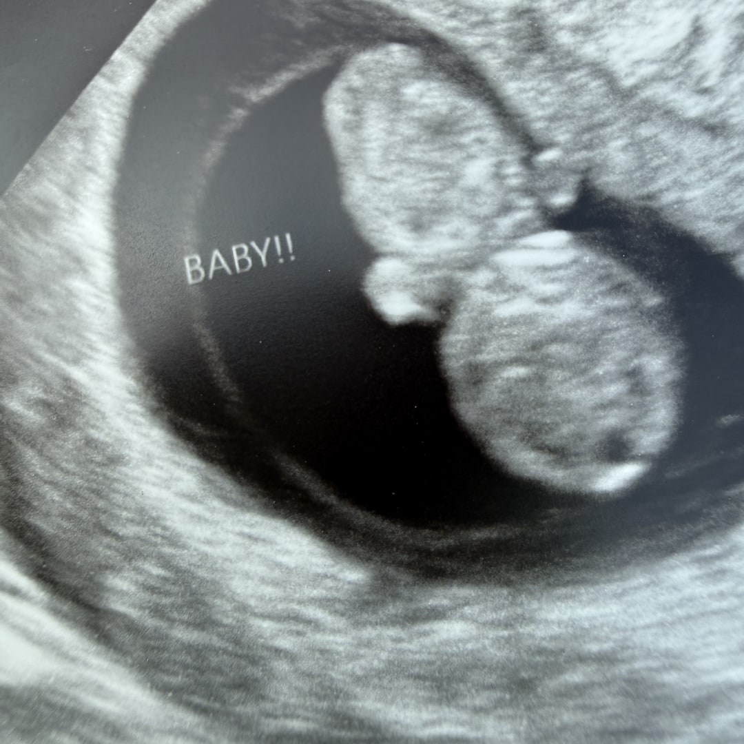 Photo shared by Elissa for their Babylist baby registry.