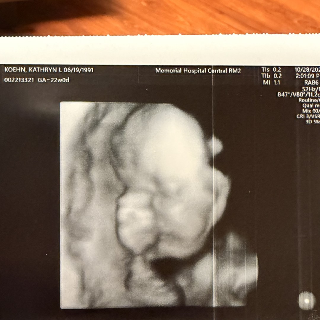 Photo shared by Kathryn for their Babylist baby registry.