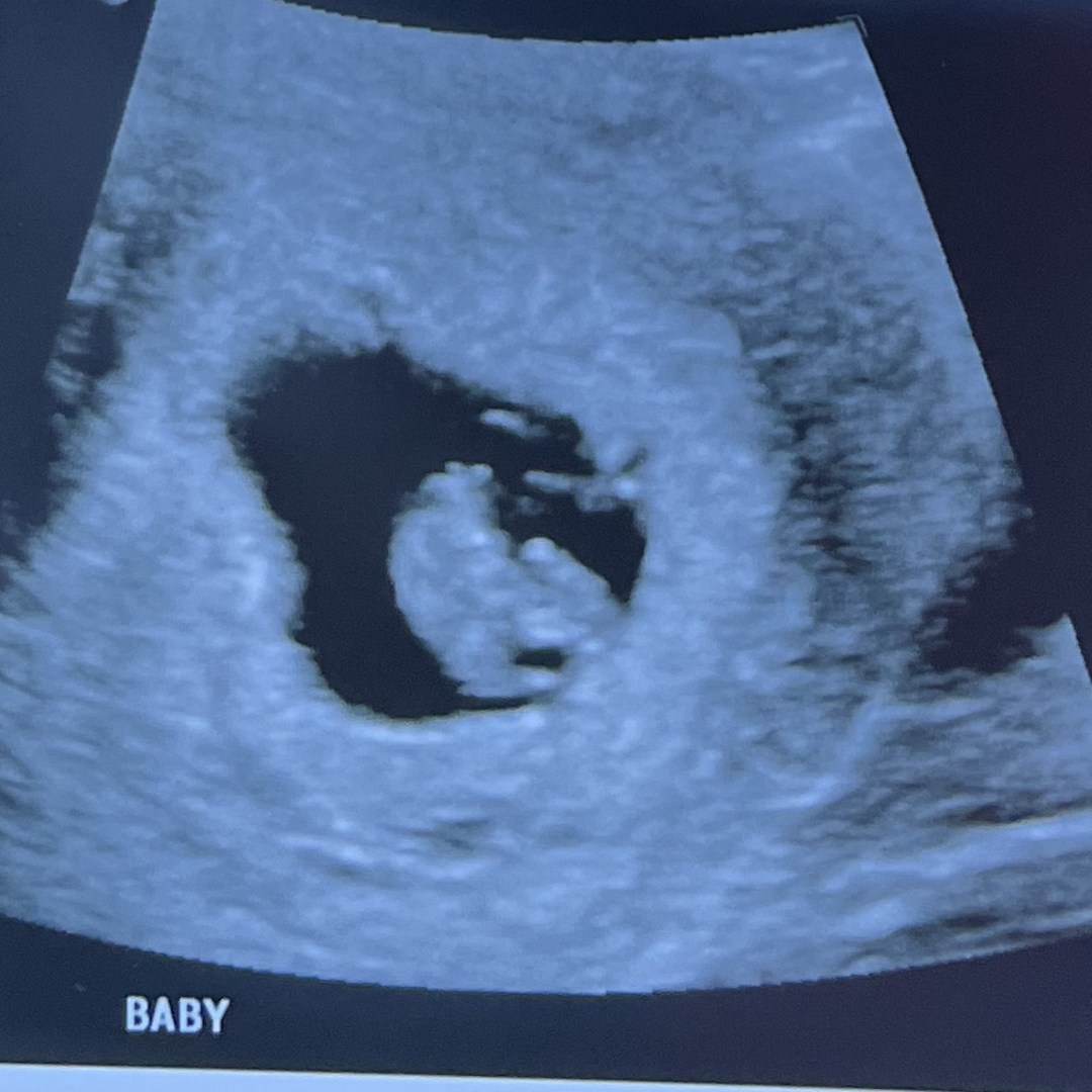 Photo shared by Ashley for their Babylist baby registry.