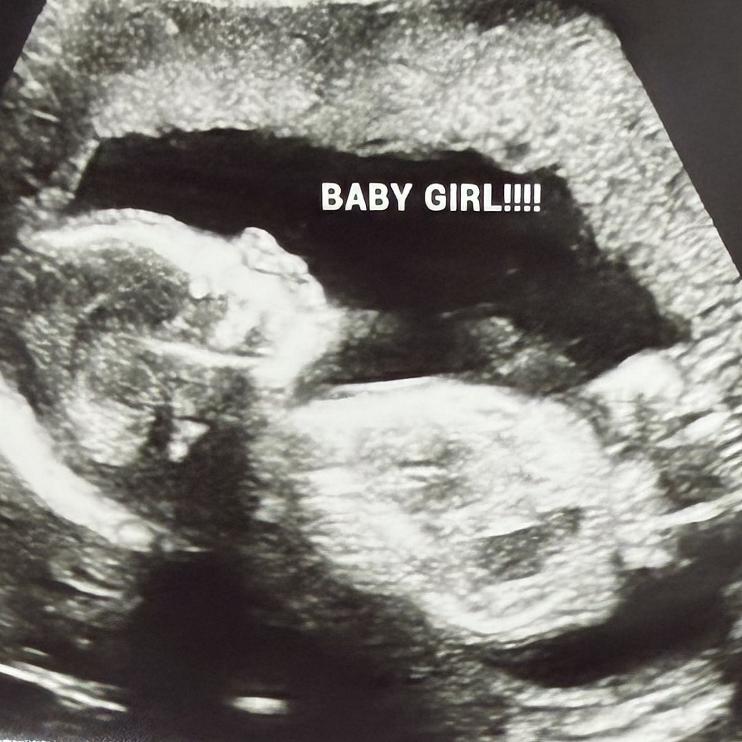 Photo shared by Leandra for their Babylist baby registry.