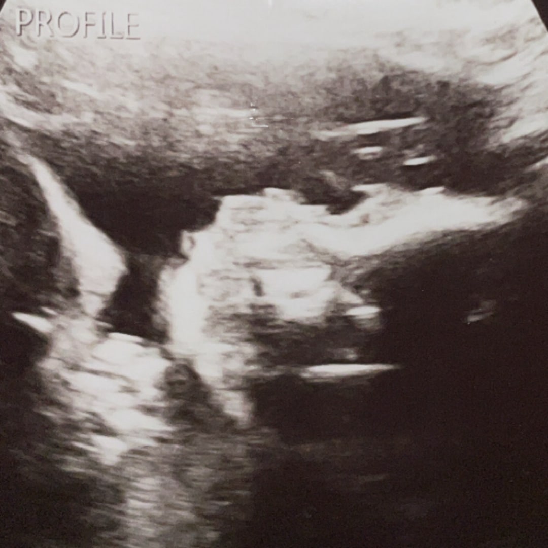 Photo shared by Belinda for their Babylist baby registry.