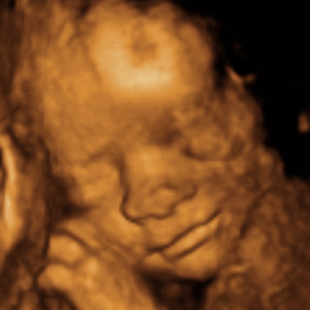 Photo shared by Briseis for their Babylist baby registry.