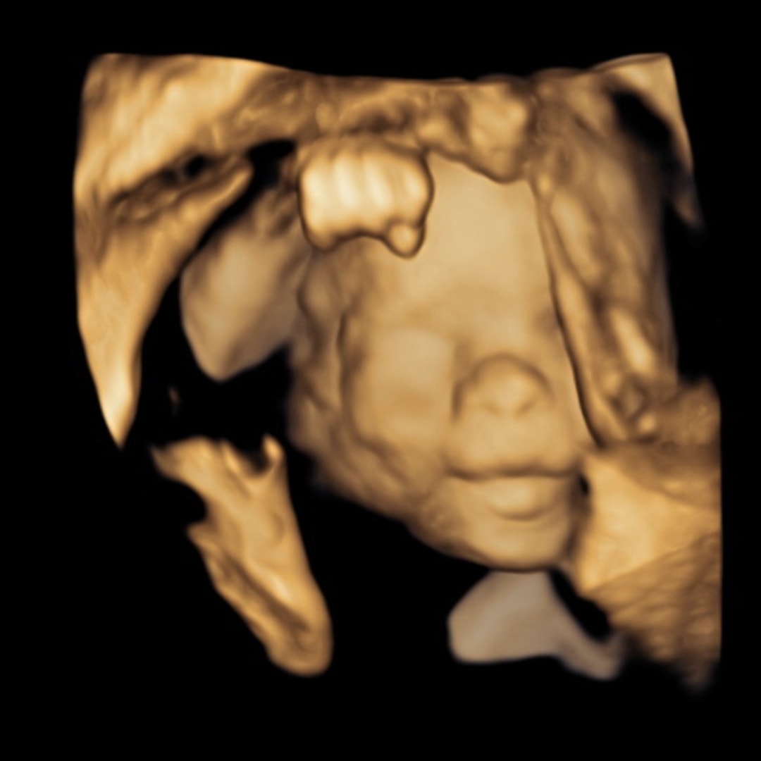 Photo shared by Ashlyn for their Babylist baby registry.